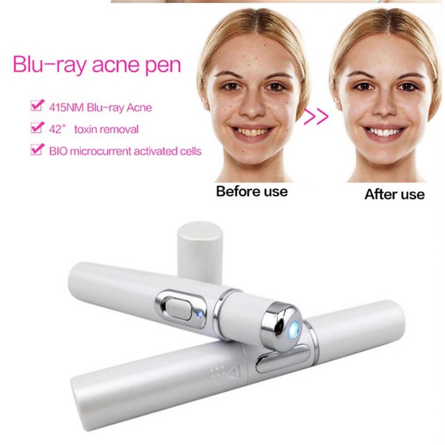 Blue Light Therapy Laser Pen