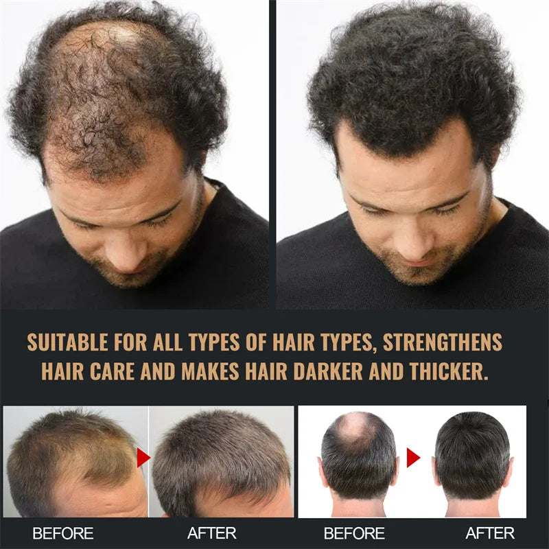 Before and after images showing the effectiveness of Hair Growth Shampoo in thickening and strengthening hair.