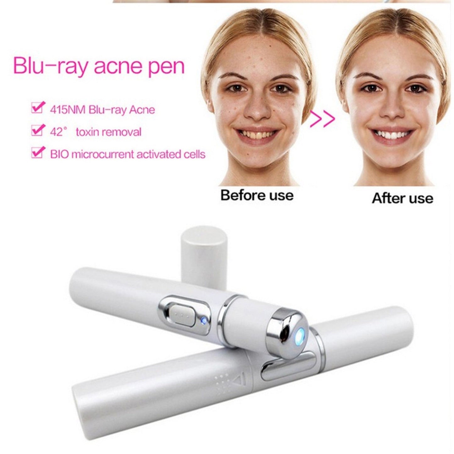 Blue Light Therapy Laser Pen