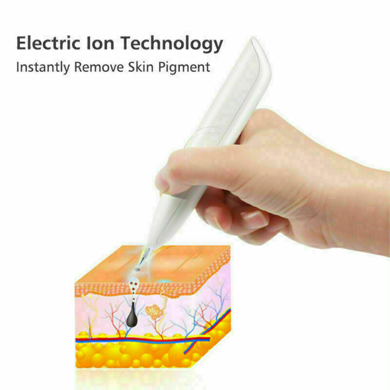 ion laser freckle skin mole dark spot remover