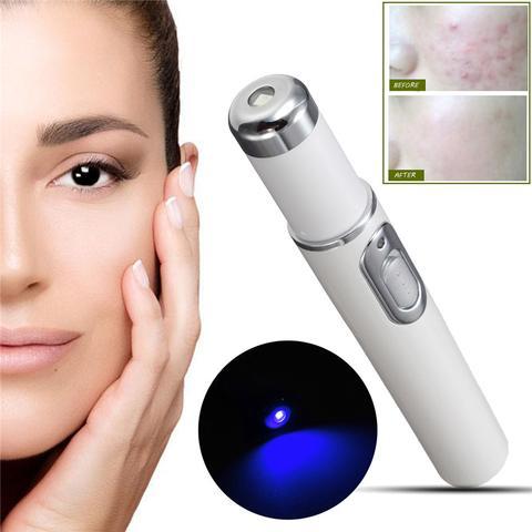 Blue Light Therapy Laser Pen