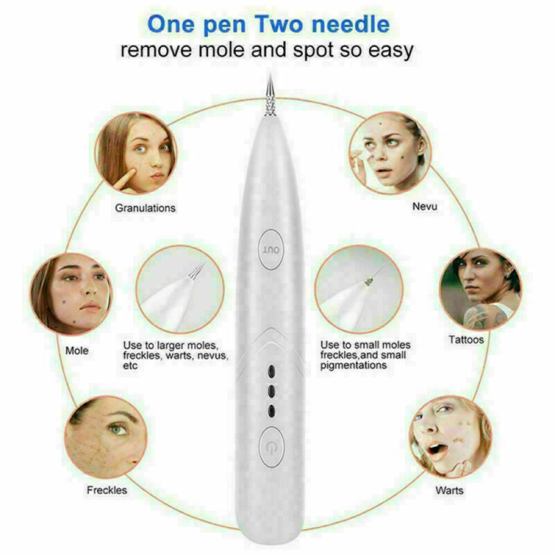 ion laser freckle skin mole dark spot remover